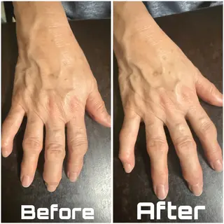 【敏感肌管理×小顔サロン】Belle orchid所属・敏感肌×小顔サロン 玲央奈のエステ・リラクイメージ