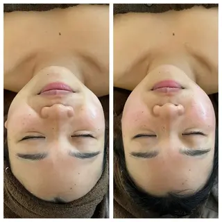 Reveur所属・Reveur REMIのエステ・リラクイメージ