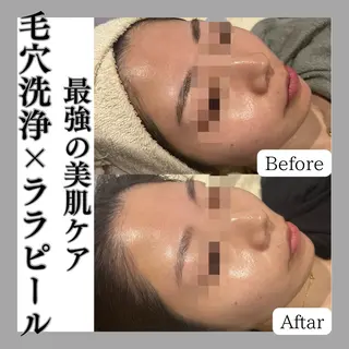 韓国肌管理専門店　White labo 梅田店所属・大西 亜季のエステ・リラクイメージ