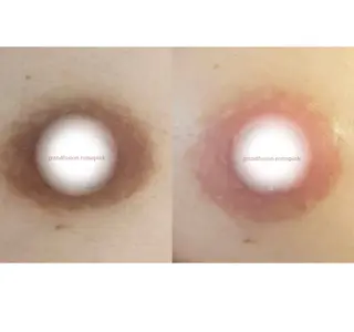 女性のお悩み美容 サロン　ヴィーナスのエステ・リラクイメージ