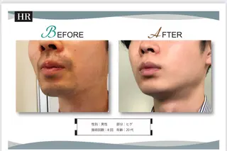 脱毛サロン　LILIAN所属・脱毛・美肌サロン LILIAN 脱石油のエステ・リラクイメージ