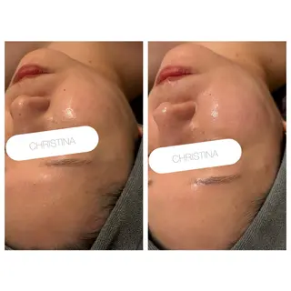 小顔コルギ ☆表参道/外苑前のエステ・リラクイメージ