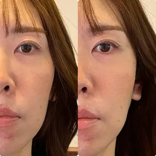 小顔矯正/姿勢矯正 美容整体師　野口杏太のエステ・リラクイメージ