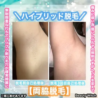 痩身/脱毛/ネイル HARUKAのエステ・リラクイメージ