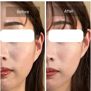 美容整体サロン　アンヨール所属・整体アンヨール 白石のエステ・リラクイメージ