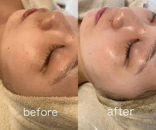 eminy所属・Yuuki 陶肌トリートメントのエステ・リラクイメージ