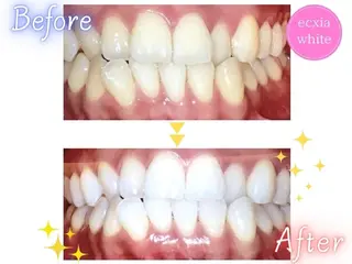 エクシアホワイト奥田店所属・エクシアホワイト 奥田店のその他イメージ