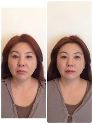 町田・鶴川 小顔矯正 /鈴木友実のその他イメージ