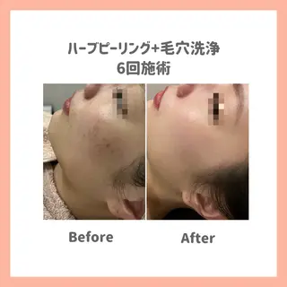 ハーブピーリング専門 muro.のエステ・リラクイメージ