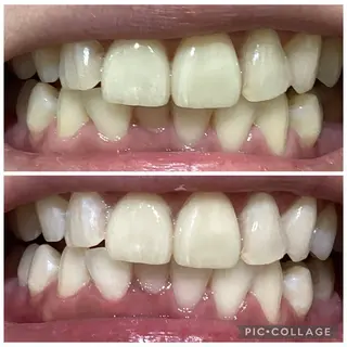 セルフホワイトニングサロン　Betee所属・セルフホワイトニング Beteeのエステ・リラクイメージ