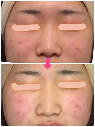 セミロング カラー パーマ ヘアアレンジ メンズ キッズ ネイル マツエク・マツパ ‍痩身＆ボディ 結果出し🌟丹野のエステ・リラクイメージ