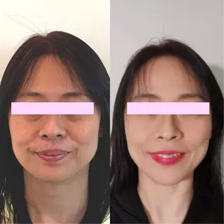 小顔矯正サロン町田 逸見智美のエステ・リラクイメージ