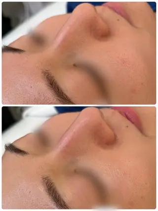 beauty salon Clochette所属・clochette misakoのエステ・リラクイメージ