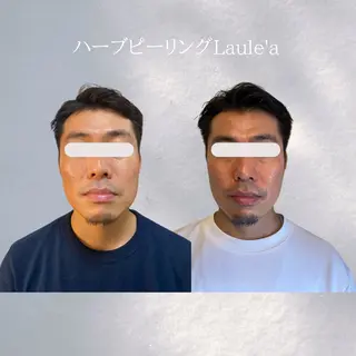 美腸サロン🌺 腸もみ/小顔/リンパのエステ・リラクイメージ