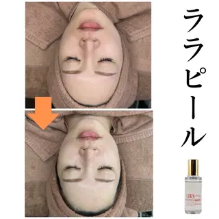 Babel 〜都度払いサロン〜のエステ・リラクイメージ