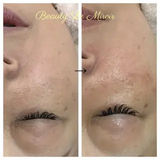 ビューティー ミロワールのエステ・リラクイメージ