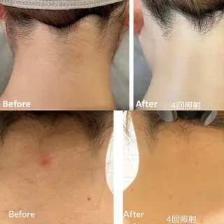 VANILLA SKY所属・VANILLA SKYのエステ・リラクイメージ