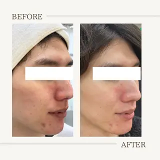 肌育成サロン ♡ RISAのエステ・リラクイメージ