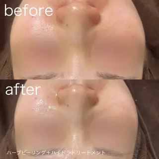 lulularico Yuのエステ・リラクイメージ