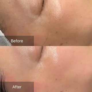 loa まつ毛と肌管理のお店のマツエク・マツパデザイン