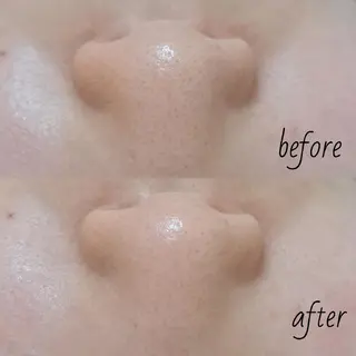 DeRiii所属・DeRiii 毛穴・ 保湿ケアまつ毛パーマのエステ・リラクイメージ