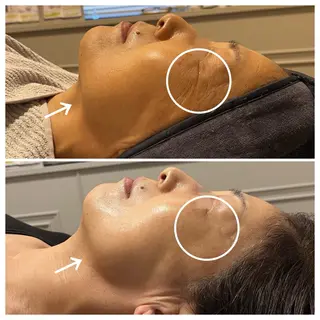 成宮鍼灸整骨院 & total  beauty  salon所属・中村 優美のエステ・リラクイメージ