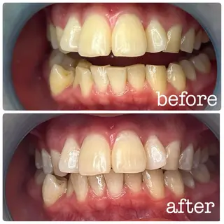 メンズ DH. MISATOの眉毛・アイブロウイメージ