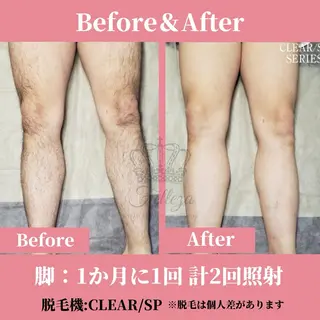 メンズ 有人型セルフサロン 脱毛/痩身/美顔のその他イメージ