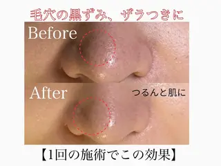 🌸🧡六本木 脱毛しずか🧡🫧の眉毛・アイブロウイメージ