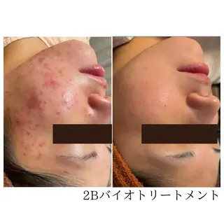 Beauty&skin Dahlia所属・ダリア 盛岡店のエステ・リラクイメージ