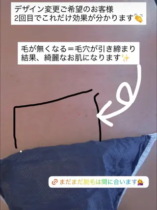 Beauty salon Wish所属・脱毛🌈肌質改善🌈 Wishのエステ・リラクイメージ