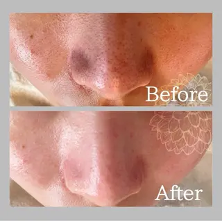 salon DAHLIA所属・salon DAHLIAのエステ・リラクイメージ