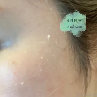 肌質改善 KALANCHOEのエステ・リラクイメージ