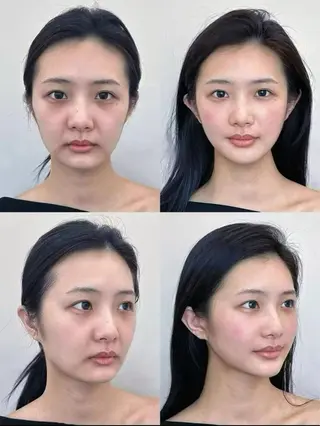 ショート aliaハイフ&水光ジェットサロン所属・aliaハーブ水光店 エステティシャン募集のエステ・リラクイメージ