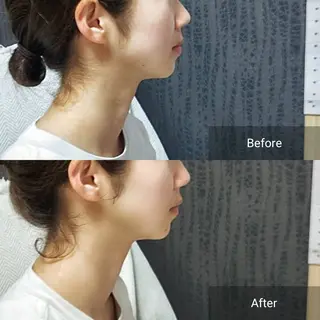 nail RiRi アトレナチュラのエステ・リラクイメージ