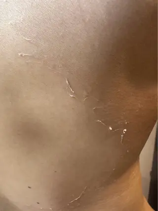 clé skin 🌿ハーブピーリングのエステ・リラクイメージ