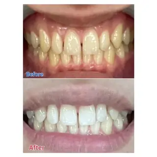 M渋谷店所属・Ｍ渋谷 ホワイトニングのエステ・リラクイメージ