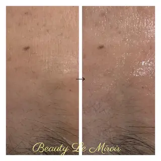 ビューティー ミロワールのエステ・リラクイメージ