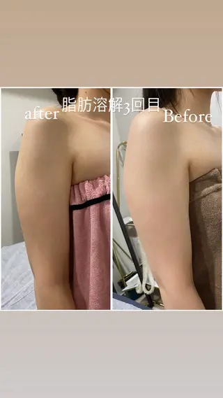 毛穴洗浄・痩身・脱毛 /アルカンジュのエステ・リラクイメージ