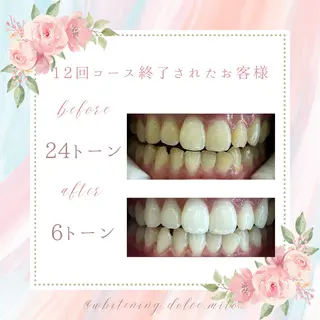 セルフホワイトニング Dolce水戸店のその他イメージ