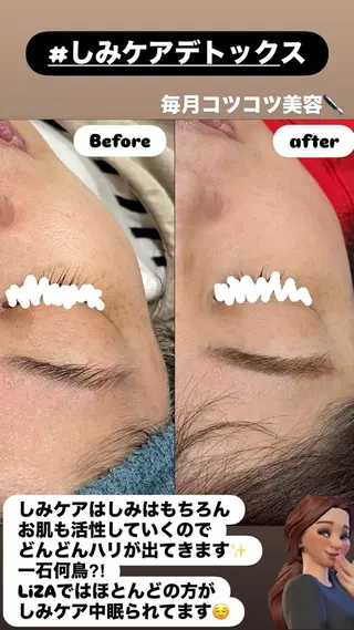 LiZA エステティックサロンのエステ・リラクイメージ