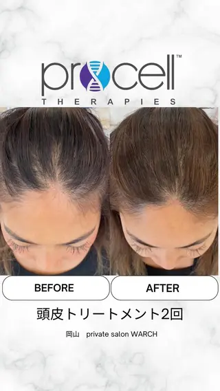 WARCH Marieのその他イメージ