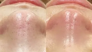 For  Seeds所属・For Seedsのエステ・リラクイメージ