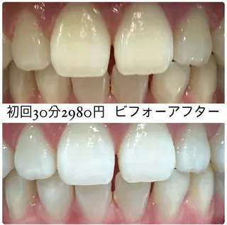 PLATINUM Beauty 横浜店所属・ホワイトニングルーム 横浜店のその他イメージ