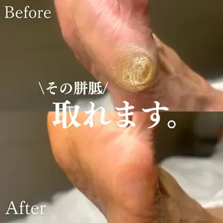 Foot Care Salon Coco 拝島店所属・Foot Salon -Coco-拝島店のエステ・リラクイメージ