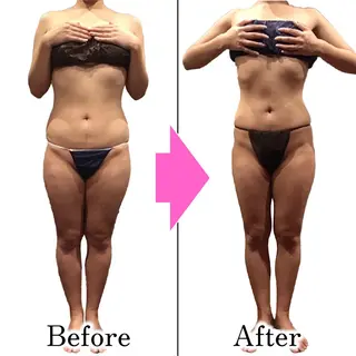 ダイエットラボ梅田店 🌟のエステ・リラクイメージ