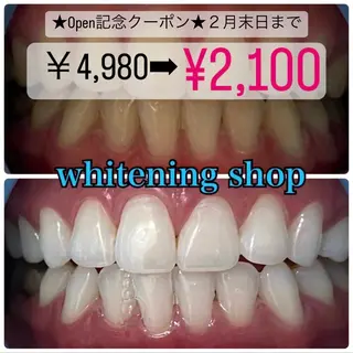 ホワイトニング ショップ千葉店のその他イメージ