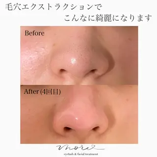 Eyelash salon MORE(モア)所属・安納 麻穂のエステ・リラクイメージ