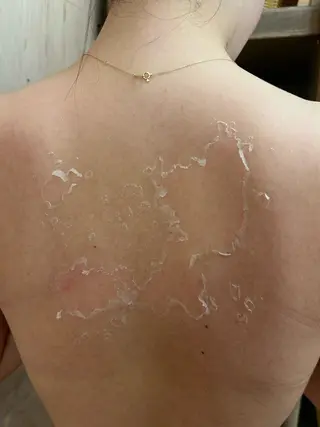 clé skin 🌿ハーブピーリングのエステ・リラクイメージ