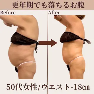 Belle White所属・本格痩身＊肌質改善＊ BelleWhiteのエステ・リラクイメージ